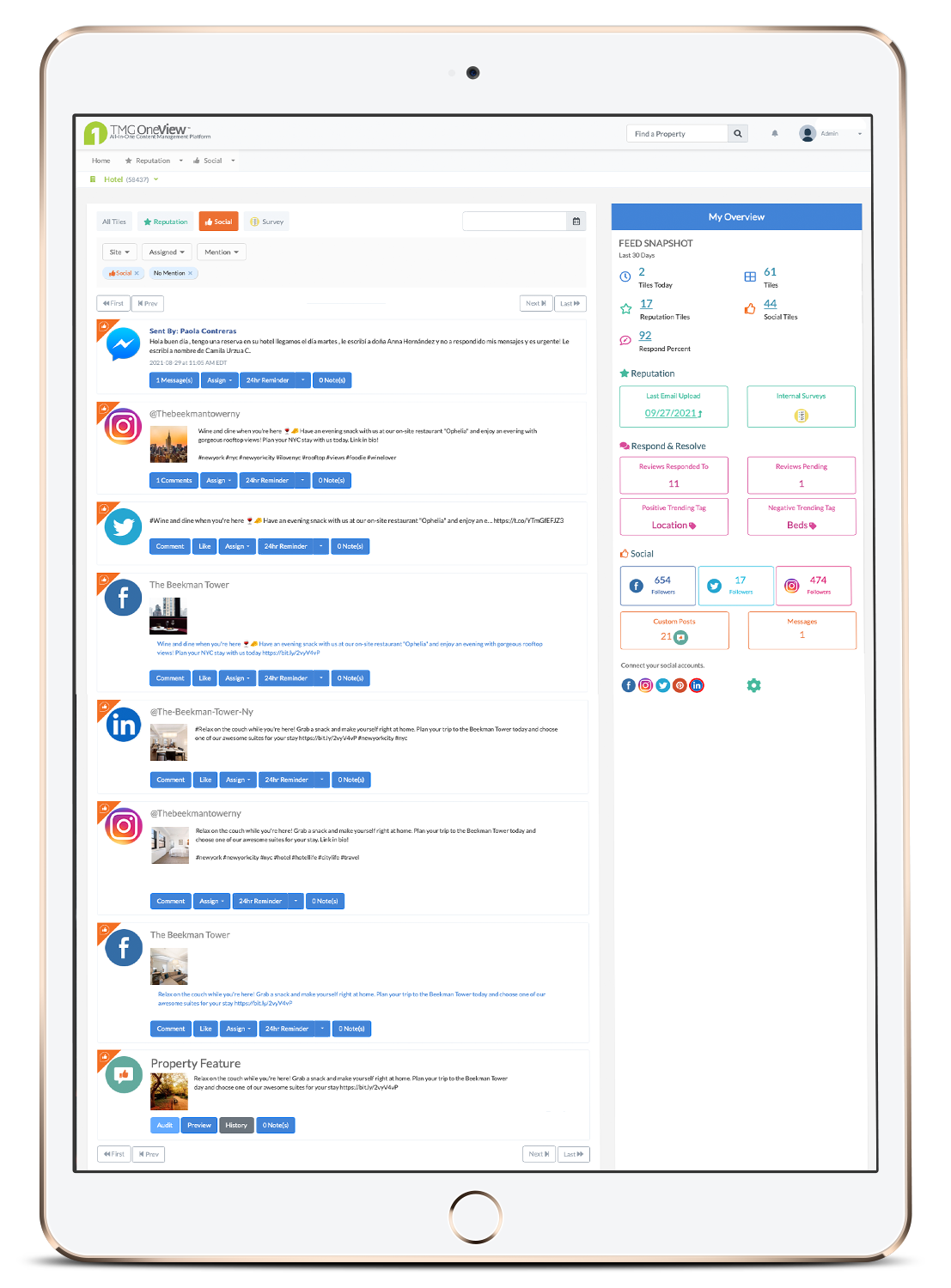 OV-SM Tablet Feed